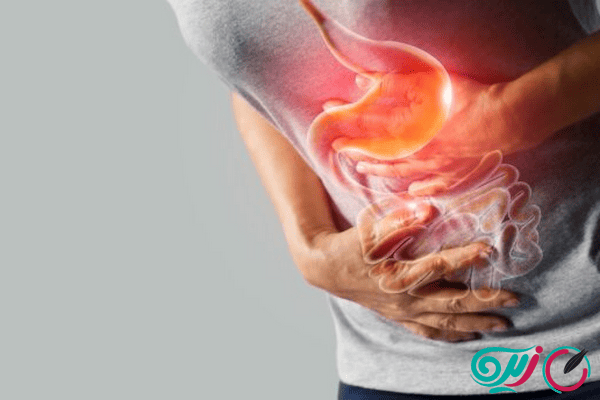 نشانه های نفخ معده